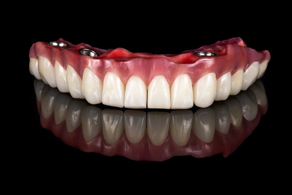 Fixed Vs Removable Implant Supported Dentures