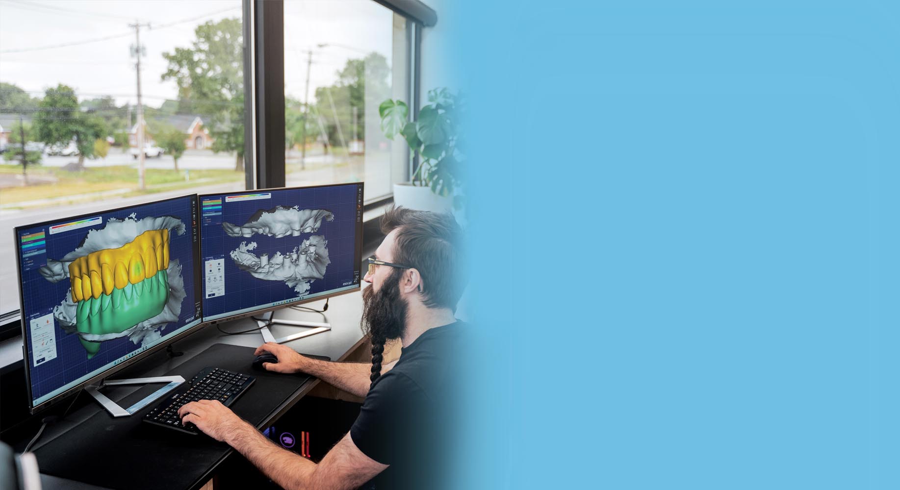 Fully Digital Process With In-House Lab 